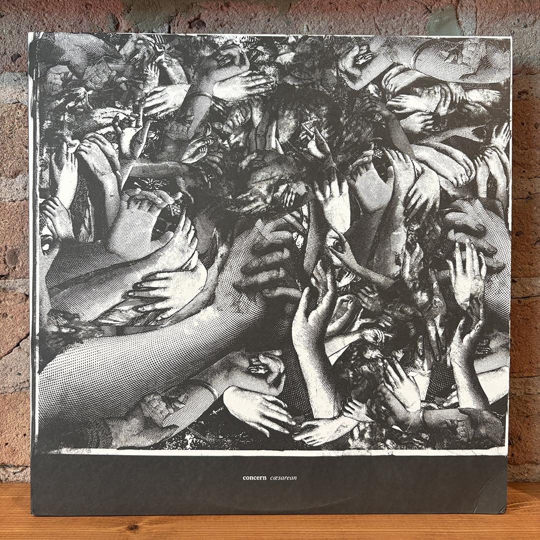 Concern – Cæsarean